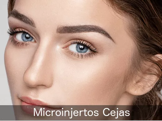 Microinjertos Cejas – exclusivamente con Clínicas IMEBA®